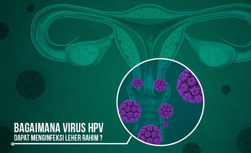 Bagaimana Virus HPV Dapat Menginfeksi Leher Rahim?